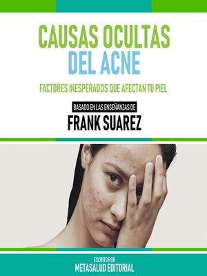 cover image of Causas Ocultas Del Acne--Basado En Las Enseñanzas De Frank Suarez